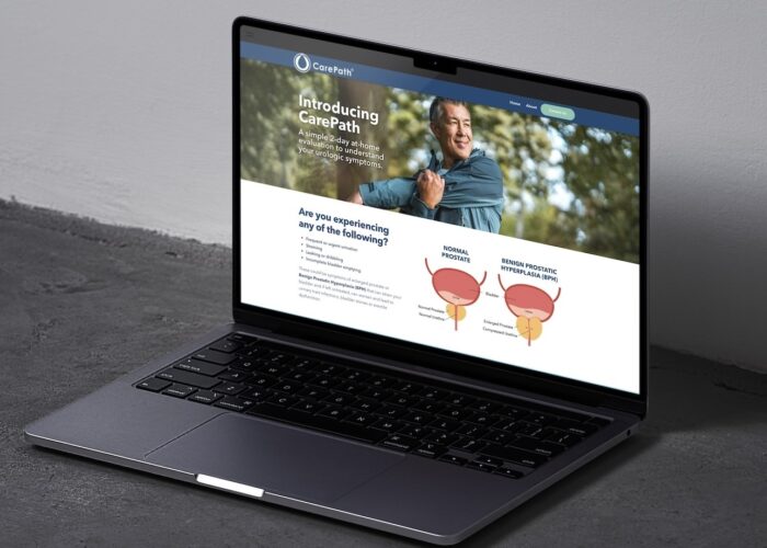 image of an open laptop with the CarePath website open, as created by io urology